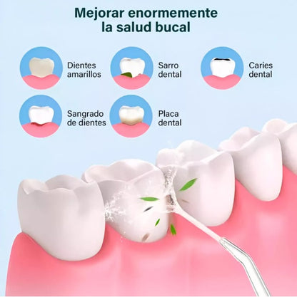 Irrigador Bucal Eléctrico Limpiador de Dientes