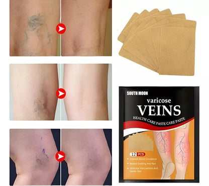 Parches para Varices Pack 2 x24 Unidades